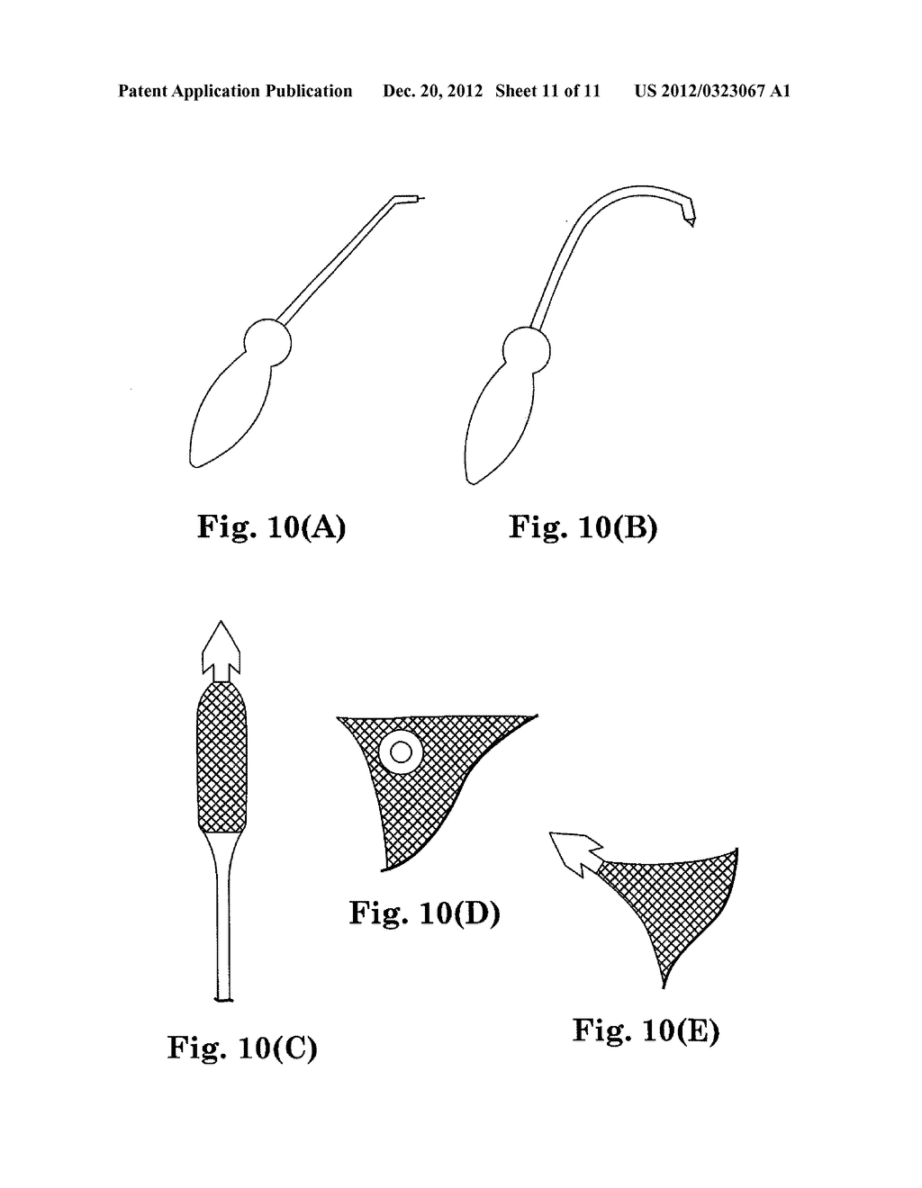 SURGICAL ARTICLES AND METHODS FOR TREATING PELVIC CONDITIONS - diagram, schematic, and image 12