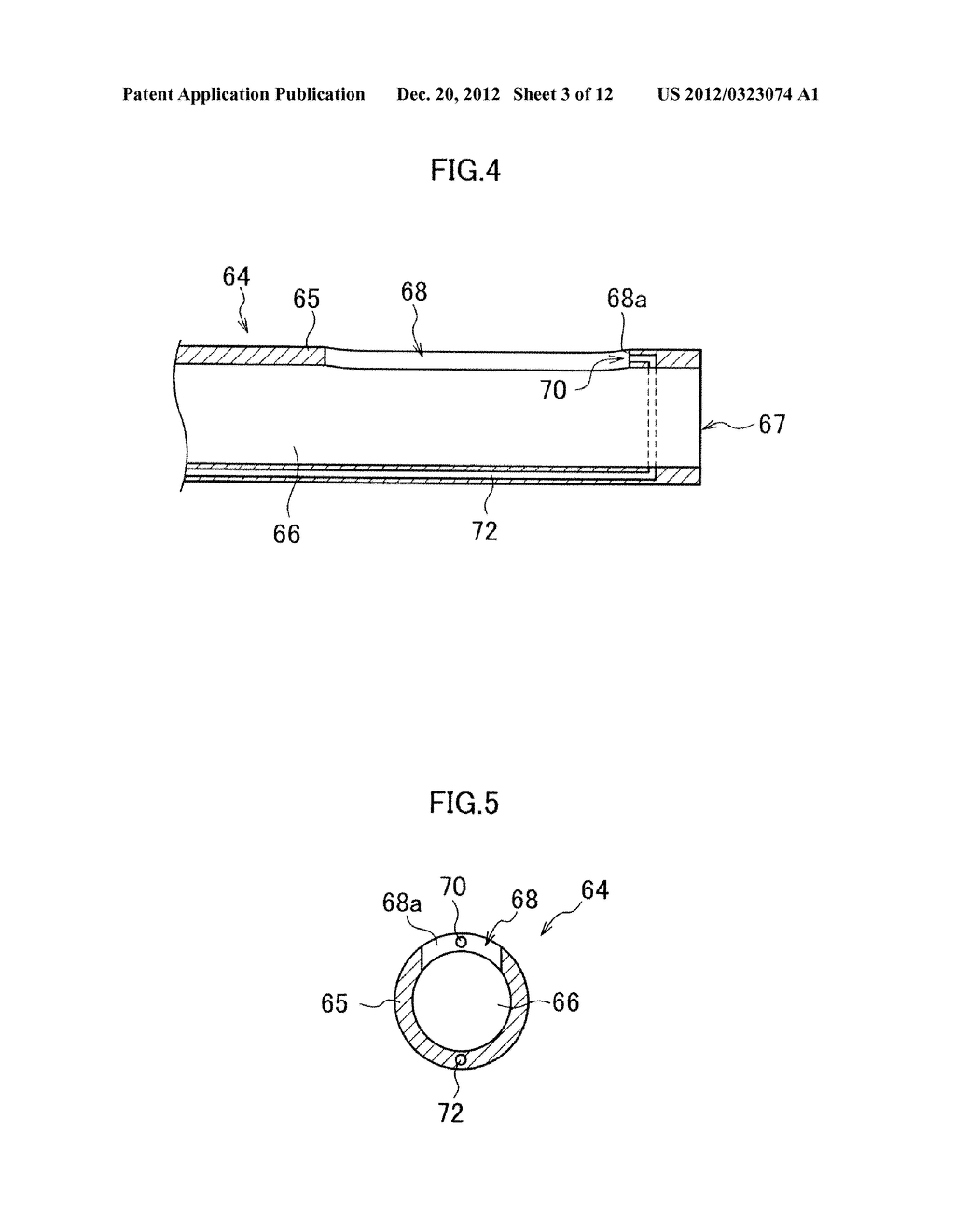 INSERTION ASSISTING TOOL FOR ENDOSCOPE - diagram, schematic, and image 04