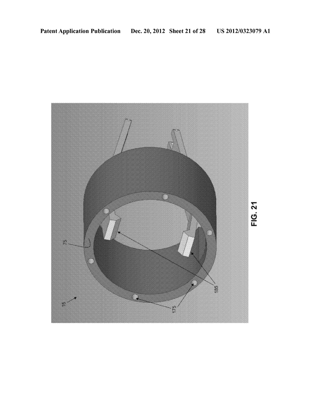 METHOD AND APPARATUS FOR MANIPULATING THE UTERUS AND/OR CERVIX OF A     PATIENT - diagram, schematic, and image 22