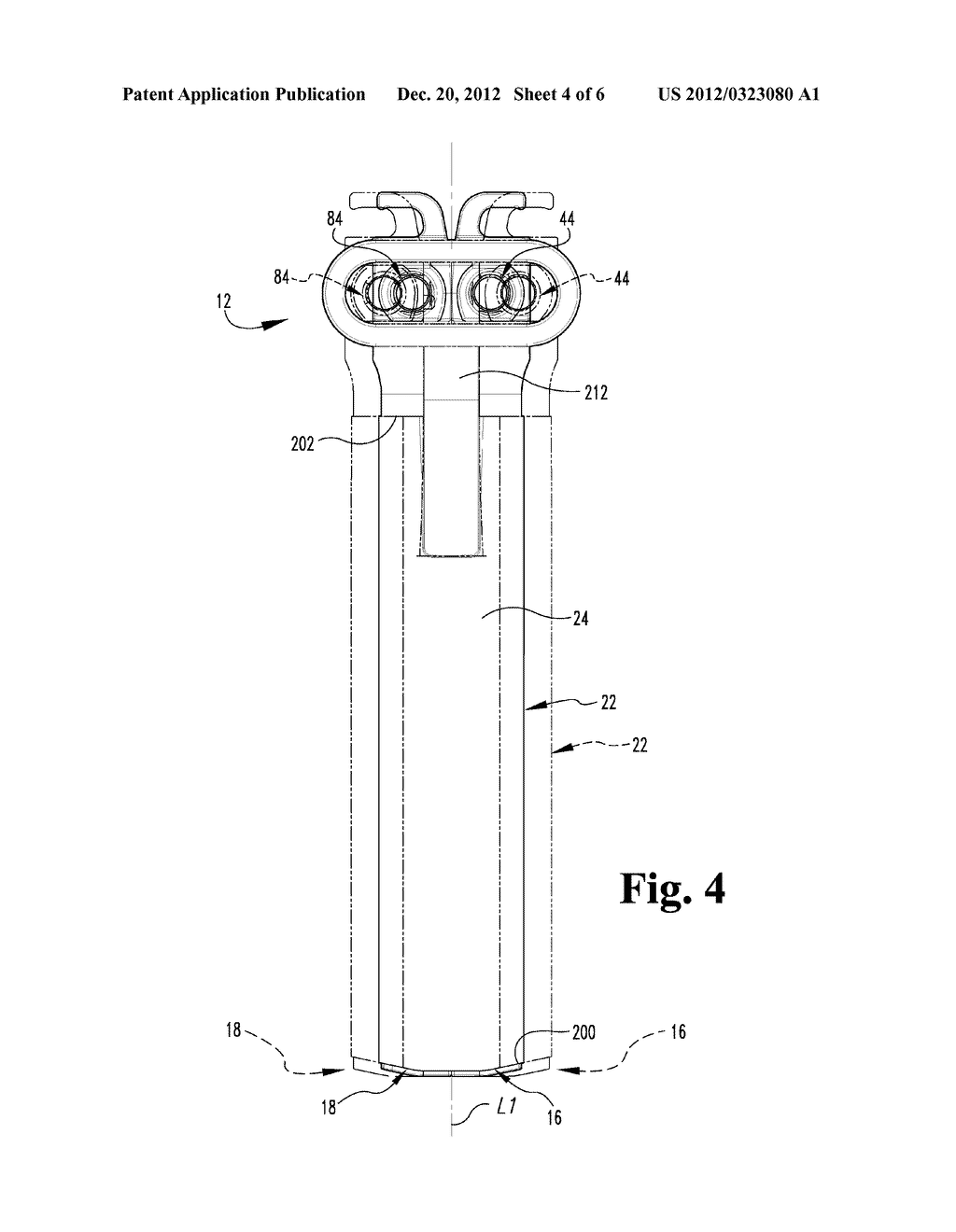 ADD-ON RETRACTOR ELEMENT FOR RETRACTOR SYSTEM - diagram, schematic, and image 05