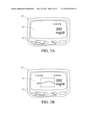 SYSTEMS AND METHODS FOR REPLACING SIGNAL ARTIFACTS IN A GLUCOSE SENSOR     DATA STREAM diagram and image