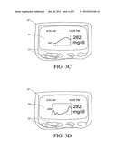 SYSTEMS AND METHODS FOR REPLACING SIGNAL ARTIFACTS IN A GLUCOSE SENSOR     DATA STREAM diagram and image