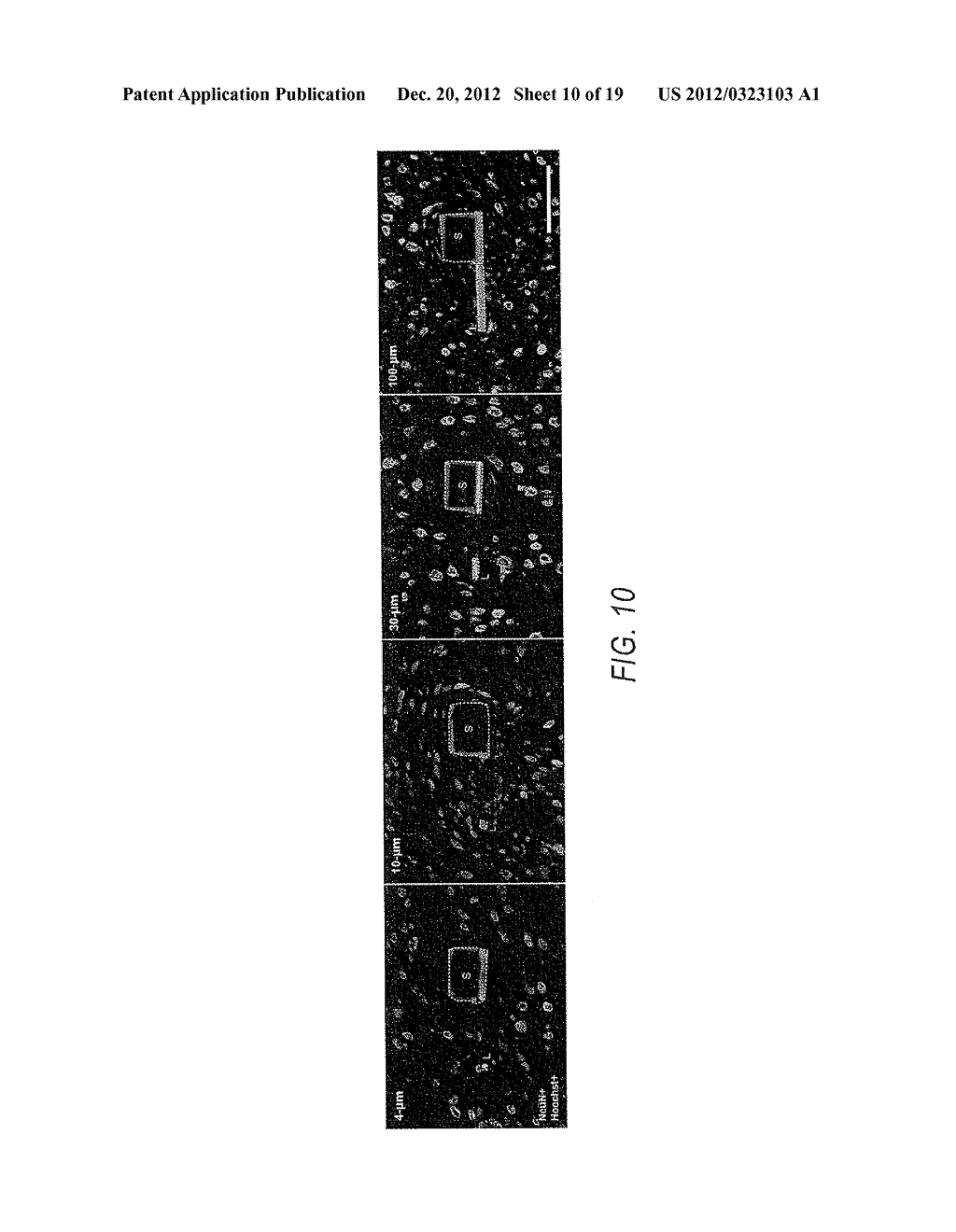 MICROELECTRODE WITH LATERALLY EXTENDING PLATFORM FOR REDUCTION OF TISSUE     ENCAPSULATION - diagram, schematic, and image 11