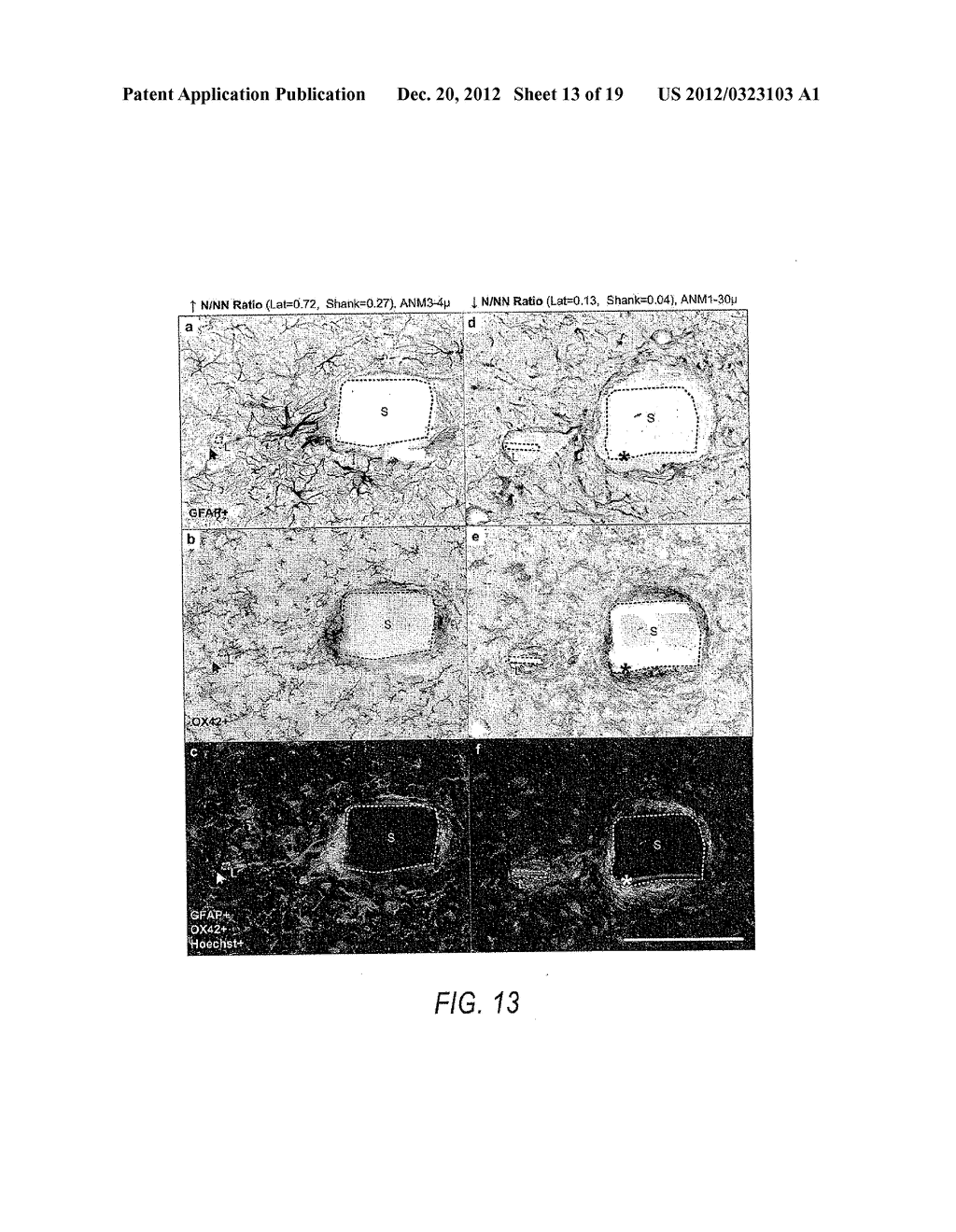 MICROELECTRODE WITH LATERALLY EXTENDING PLATFORM FOR REDUCTION OF TISSUE     ENCAPSULATION - diagram, schematic, and image 14