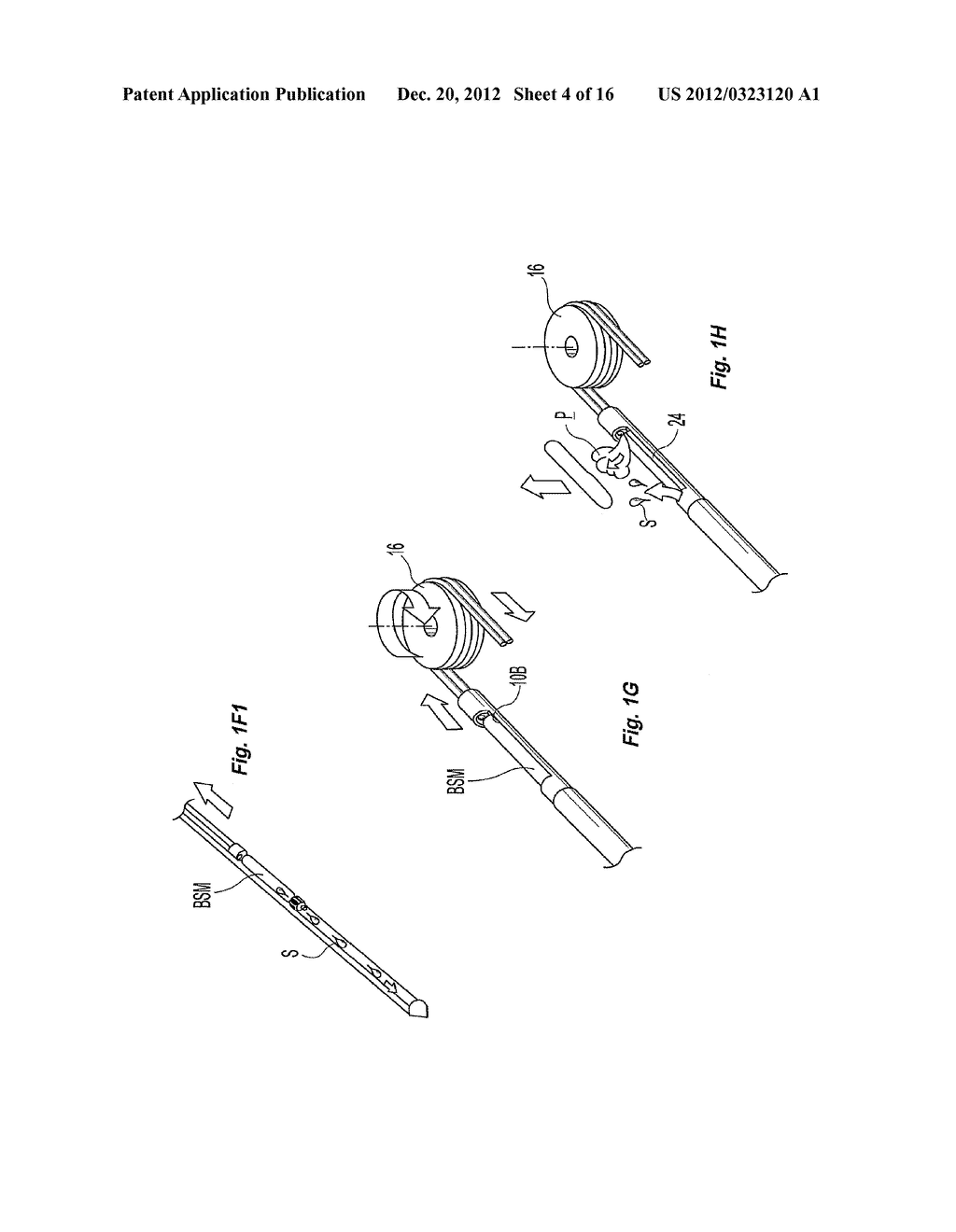 SINGLE-INSERTION, MULTIPLE SAMPLE BIOPSY DEVICE WITH INTEGRATED MARKERS - diagram, schematic, and image 05