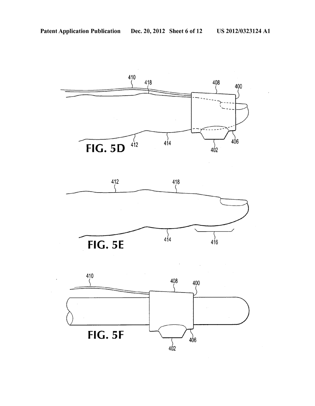PROBE WITH DORSAL CONNECTIVITY - diagram, schematic, and image 07