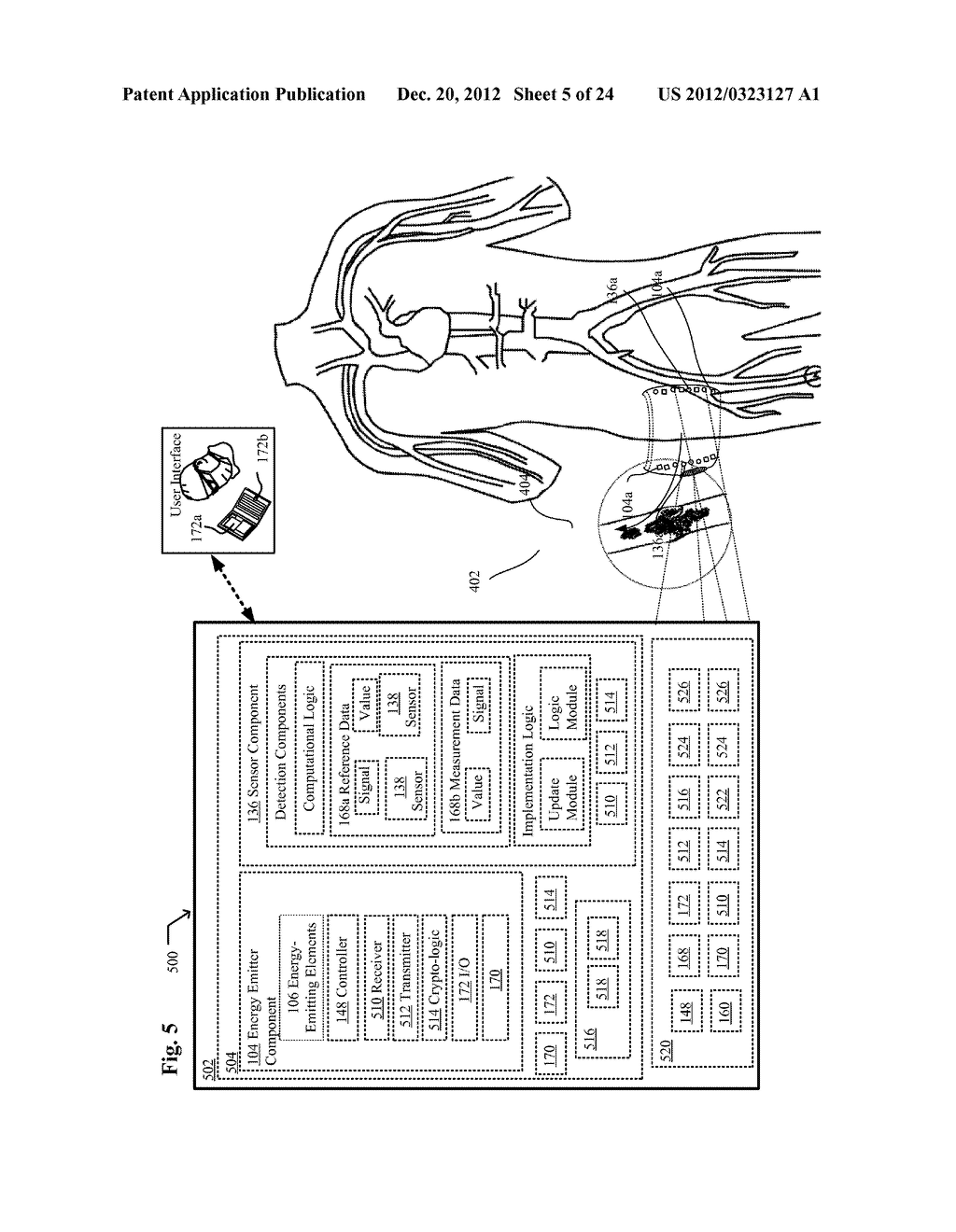 System, Devices, and Methods For Detecting Occlusions In A Biological     Subject - diagram, schematic, and image 06