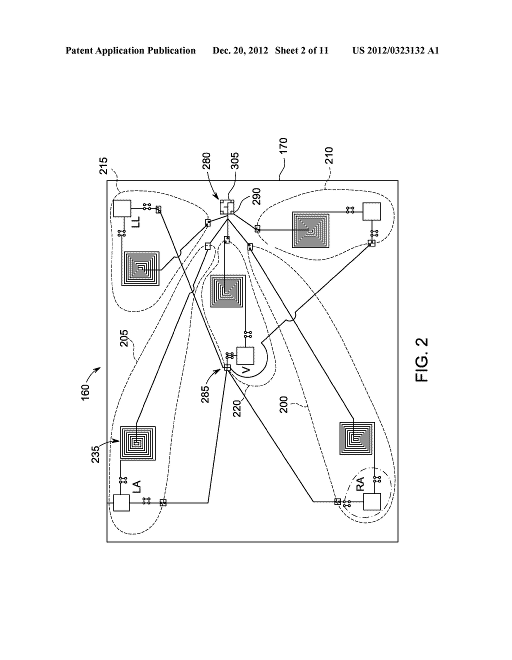 SYSTEM AND METHOD OF NOISE REDUCTION IN AN ELECTROCARDIOLOGY STUDY - diagram, schematic, and image 03