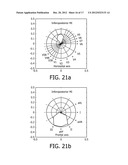 IDENTIFICATION OF CULPRIT CORONARY ARTERY USING ANATOMICALLY ORIENTED ECG     DATA FROM EXTENDED LEAD SET diagram and image