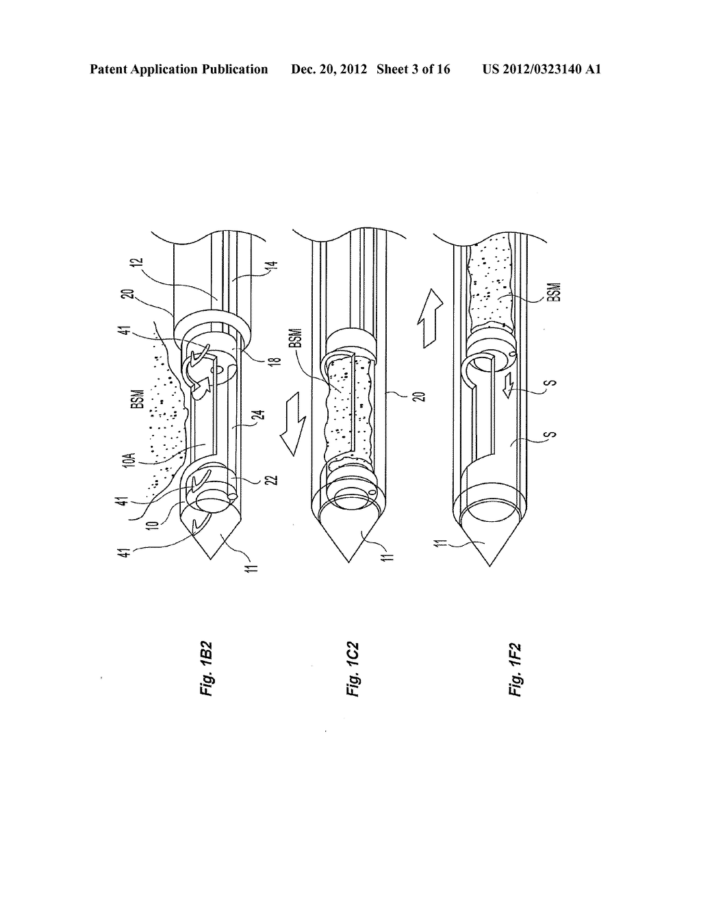 SINGLE-INSERTION, MULTIPLE SAMPLE BIOPSY DEVICE WITH INTEGRATED MARKERS - diagram, schematic, and image 04