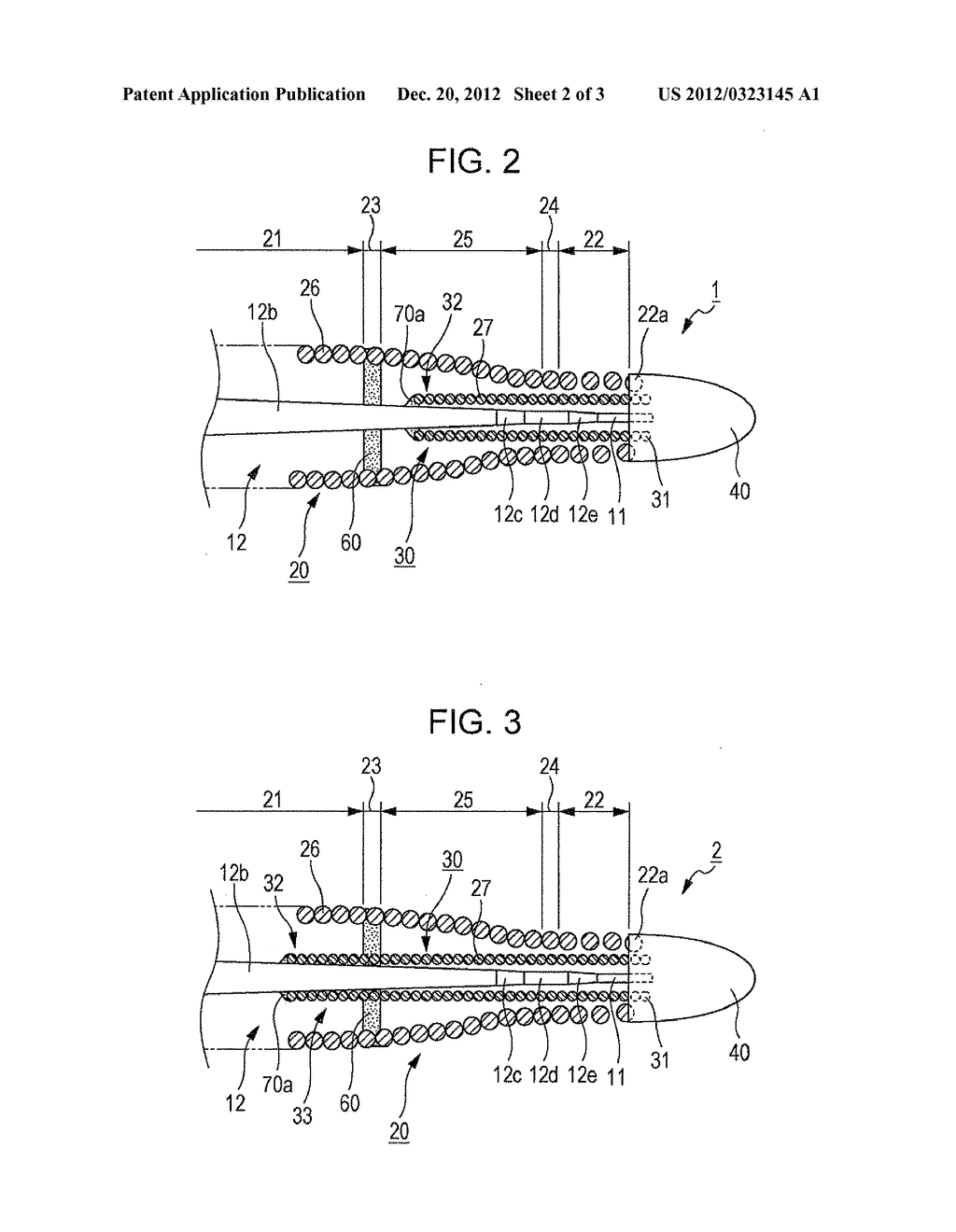 GUIDEWIRE - diagram, schematic, and image 03