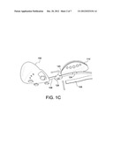 ORTHOPEDIC DEVICE, USE OF ORTHOPEDIC DEVICE AND METHOD FOR PRODUCING SAME diagram and image