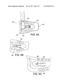 ORTHOPEDIC DEVICE, USE OF ORTHOPEDIC DEVICE AND METHOD FOR PRODUCING SAME diagram and image