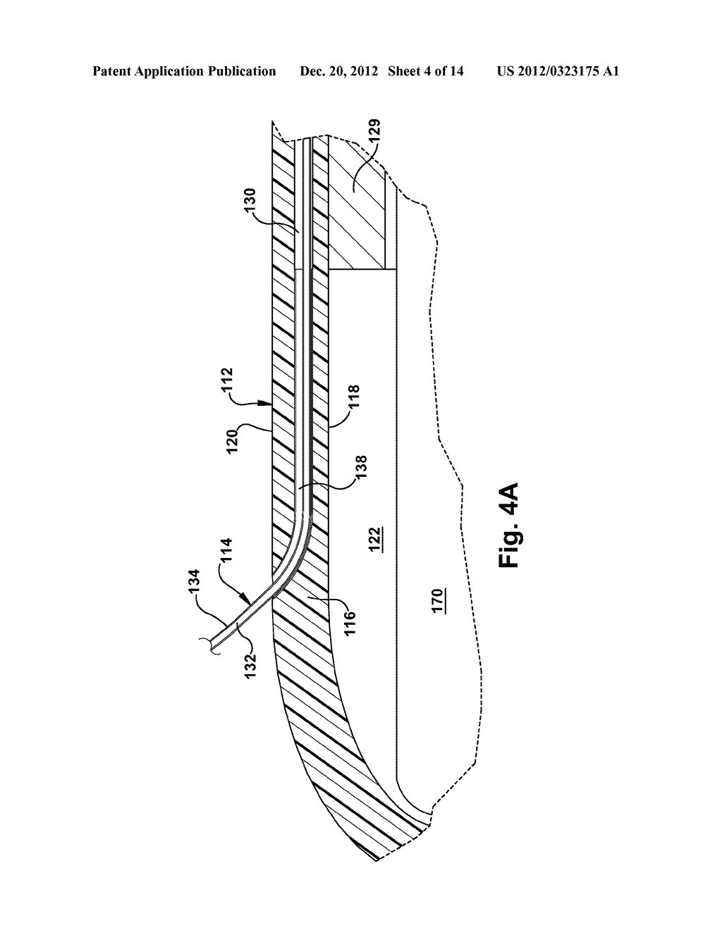 CATHETER ASSEMBLY - diagram, schematic, and image 05