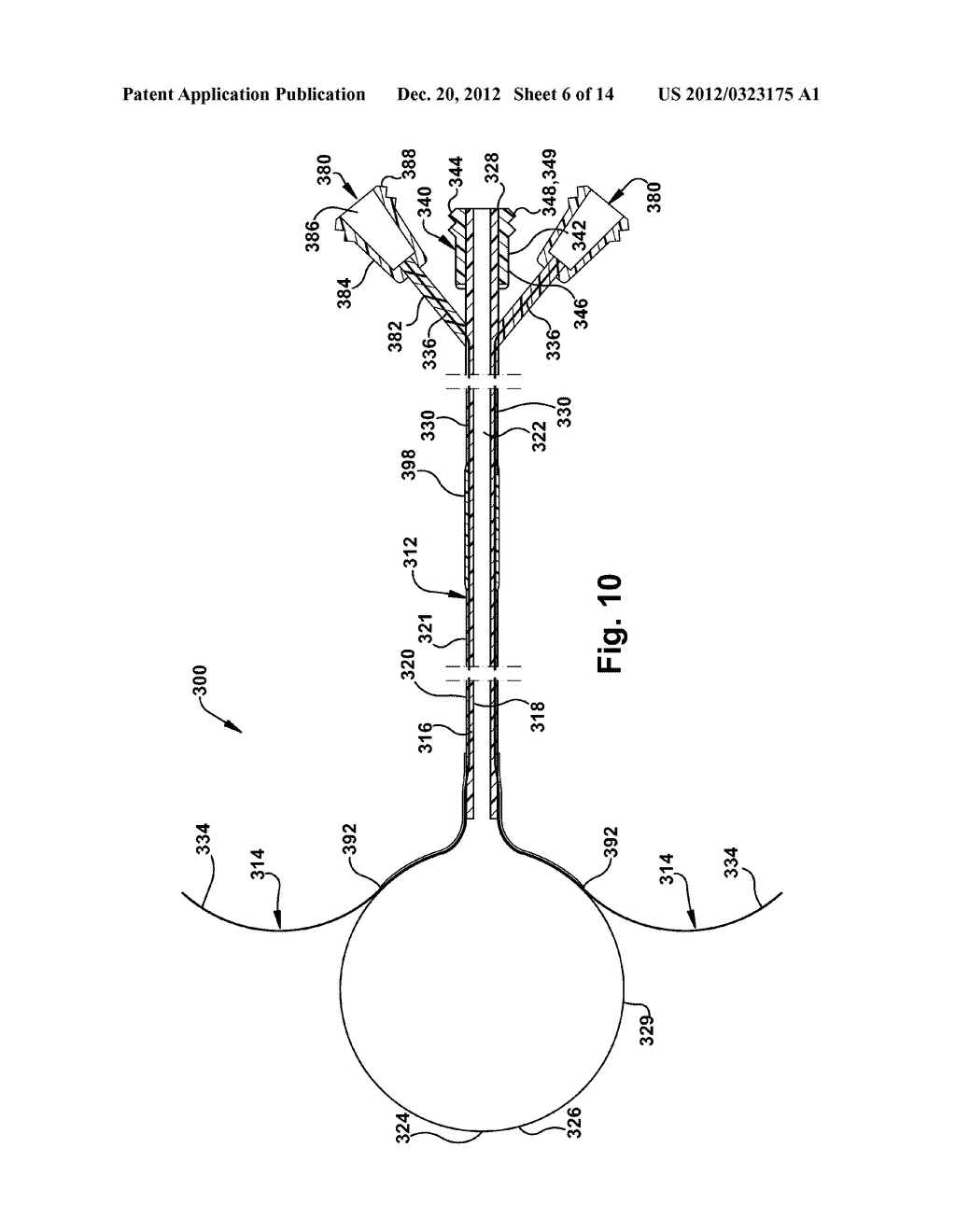 CATHETER ASSEMBLY - diagram, schematic, and image 07