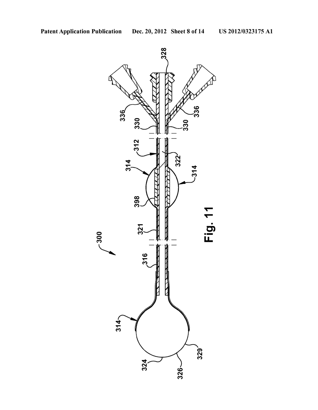 CATHETER ASSEMBLY - diagram, schematic, and image 09