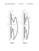 OSTOMY DEVICE diagram and image