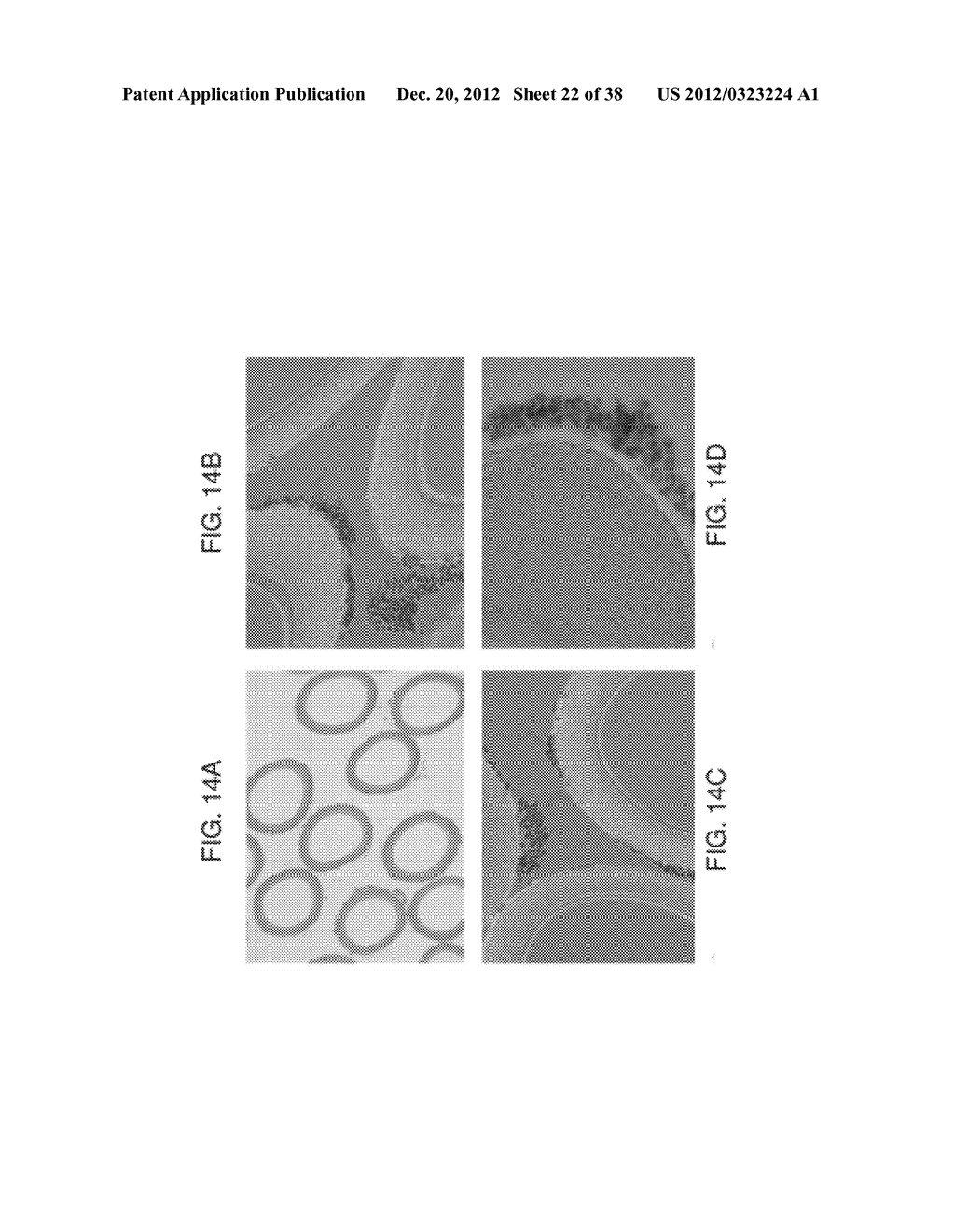 SELECTIVE CYTOPHERESIS DEVICES AND RELATED METHODS THEREOF - diagram, schematic, and image 23