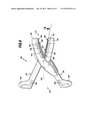 SURGICAL SYSTEM AND CONTROL PROCESS FOR A SURGICAL INSTRUMENT AND PROCESS     FOR CONNECTING BODILY TISSUES diagram and image