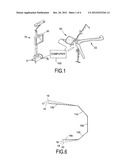 SYSTEM AND METHOD FOR BONE PREPARATION FOR AN IMPLANT diagram and image