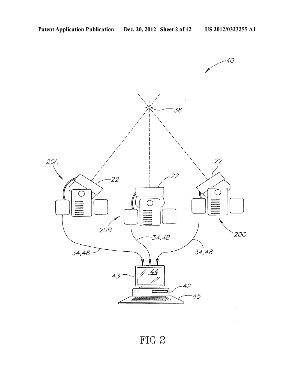 LOCALIZATION OF A RADIOACTIVE SOURCE WITHIN A BODY OF A SUBJECT - diagram, schematic, and image 03