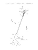 SUTURING ASSEMBLY PROVIDING BI-DIRECTIONAL NEEDLE MOVEMENT THROUGH     UNI-DIRECTIONAL ACTUATOR MOVEMENT diagram and image