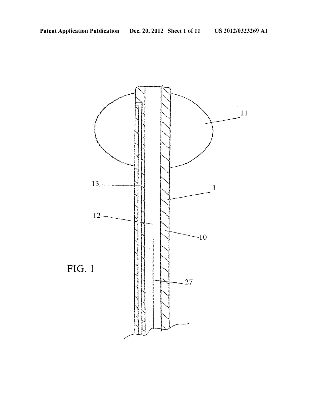 LUMEN REENTRY DEVICES AND METHODS - diagram, schematic, and image 02