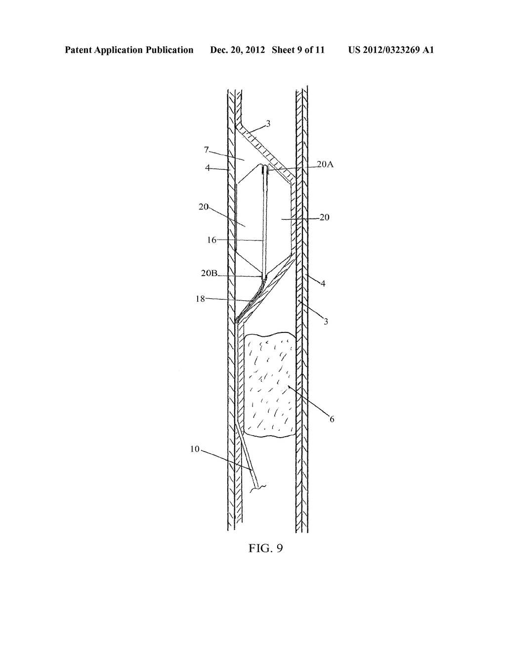 LUMEN REENTRY DEVICES AND METHODS - diagram, schematic, and image 10