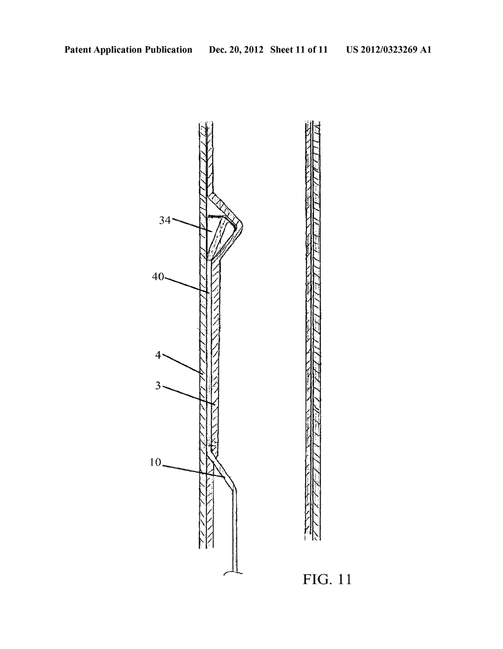 LUMEN REENTRY DEVICES AND METHODS - diagram, schematic, and image 12