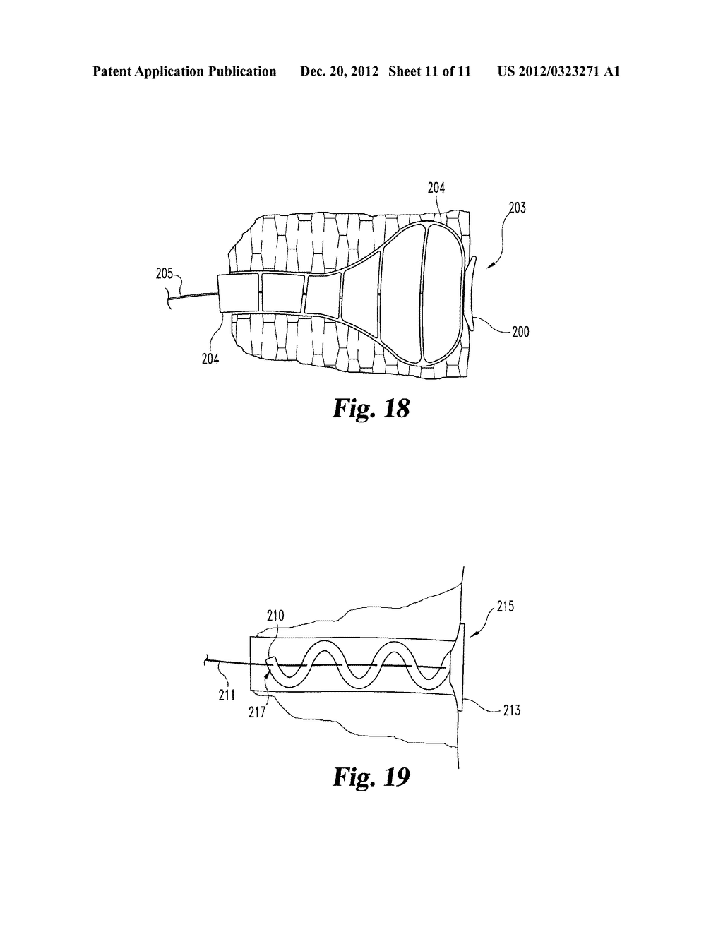 FISTULA CLOSURE DEVICES AND METHODS - diagram, schematic, and image 12