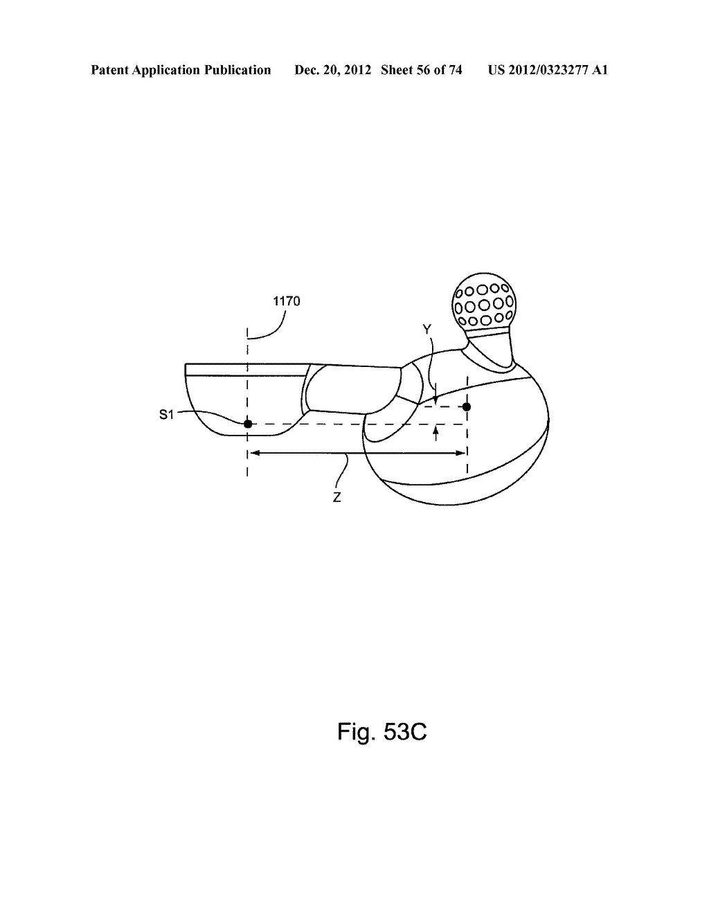 Spinal Facet Implants with Mating Articulating Bearing Surface and Methods     of Use - diagram, schematic, and image 57