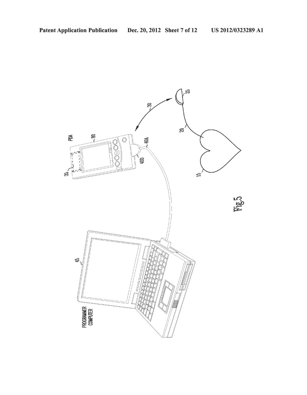 METHOD AND APPARATUS FOR ESTABLISHING CONTEXT AMONG EVENTS AND OPTIMIZING     IMPLANTED MEDICAL DEVICE PERFORMANCE - diagram, schematic, and image 08