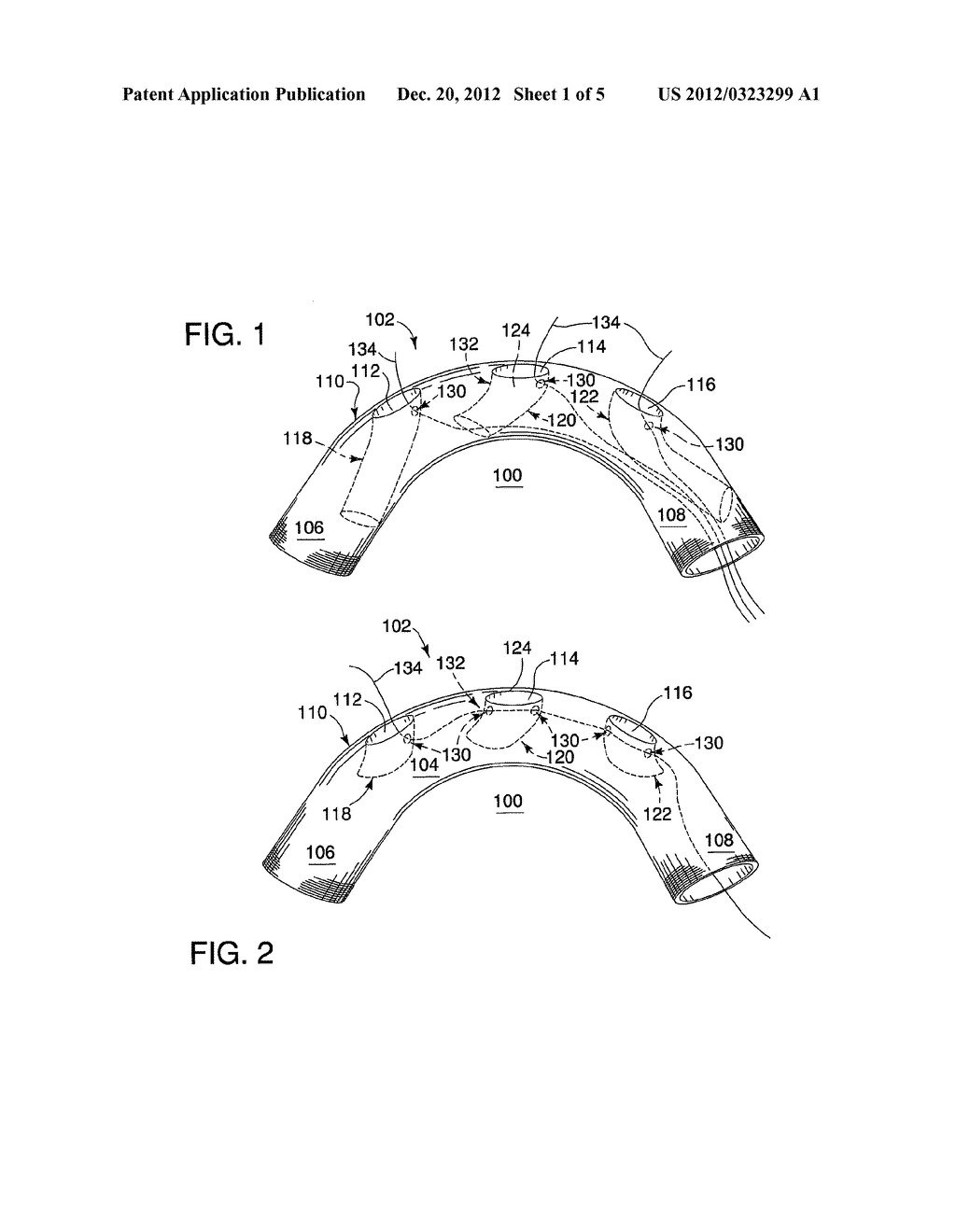 ROTATIONAL ALIGNMENT WIRE SYSTEM FOR AN ENDOVASCULAR DELIVERY SYSTEM - diagram, schematic, and image 02