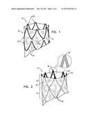 STENTS INCORPORATING A PLURALITY OF STRAIN-DISTRIBUTION LOCATIONS diagram and image