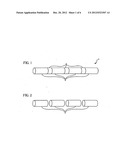 HYBRID STENT diagram and image