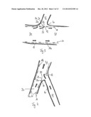 STENT WITH FLAPS diagram and image