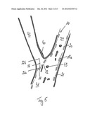 STENT WITH FLAPS diagram and image