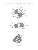 STENT WITH FLAPS diagram and image