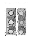 STENTS HAVING CONTROLLED ELUTION diagram and image