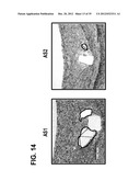 STENTS HAVING CONTROLLED ELUTION diagram and image