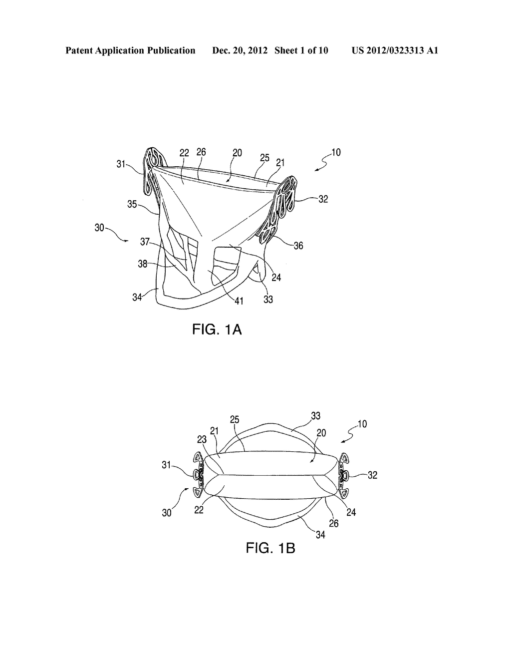 PROSTHETIC LEAFLET ASSEMBLY FOR REPAIRING A DEFECTIVE CARDIAC VALVE AND     METHODS OF USING THE SAME - diagram, schematic, and image 02