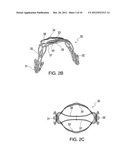 PROSTHETIC LEAFLET ASSEMBLY FOR REPAIRING A DEFECTIVE CARDIAC VALVE AND     METHODS OF USING THE SAME diagram and image