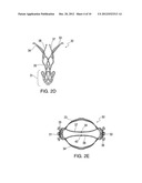 PROSTHETIC LEAFLET ASSEMBLY FOR REPAIRING A DEFECTIVE CARDIAC VALVE AND     METHODS OF USING THE SAME diagram and image