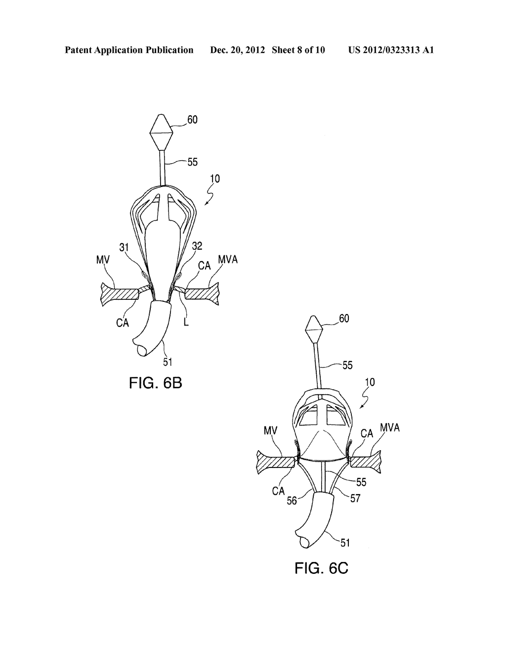 PROSTHETIC LEAFLET ASSEMBLY FOR REPAIRING A DEFECTIVE CARDIAC VALVE AND     METHODS OF USING THE SAME - diagram, schematic, and image 09