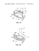 PROSTHETIC LEAFLET ASSEMBLY FOR REPAIRING A DEFECTIVE CARDIAC VALVE AND     METHODS OF USING THE SAME diagram and image