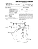 EPICARDIAL CLIP diagram and image