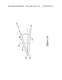 EPICARDIAL CLIP diagram and image