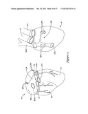 EPICARDIAL CLIP diagram and image