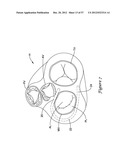 EPICARDIAL CLIP diagram and image