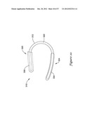 EPICARDIAL CLIP diagram and image